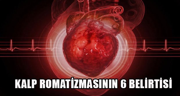 Kalp Romatizmasını Gösteren 6 Belirti