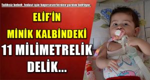 11 Aylık Minik Elif’in Kalbindeki 11 Milimetrelik Delikle Mücadelesi