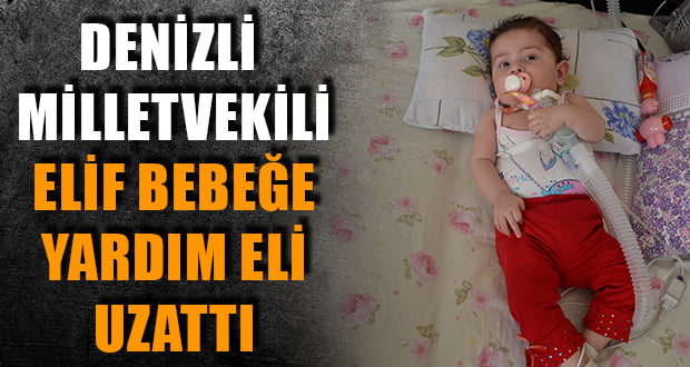 Denizli Milletvekili, Elif Bebeğe Yardım Eli Uzattı