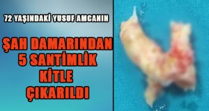 Şah Damarında 5 Santimlik Kitle Çıkarıldı