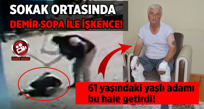 Sokak Ortasında Demir Sopa İle İşkence!