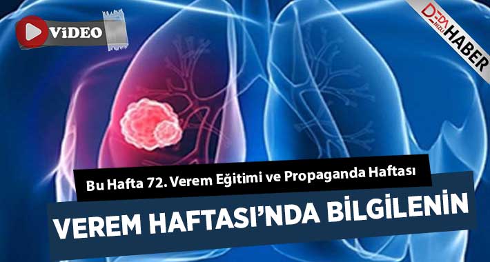 Verem Haftası’nda Bilgilenin