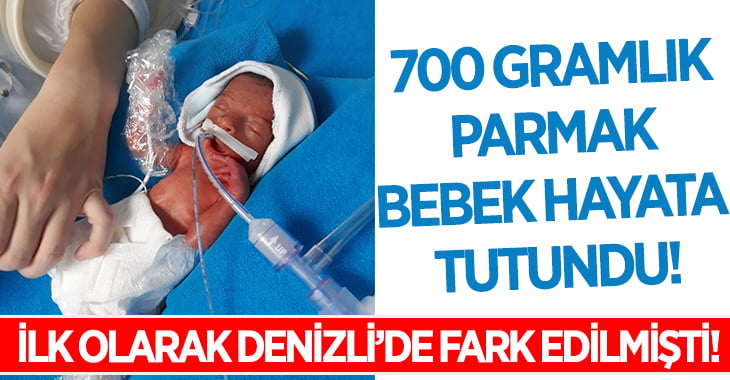 Denizli’de Fark Edildi.. 700 Gramlık Parmak Bebek Hayata Tutundu!