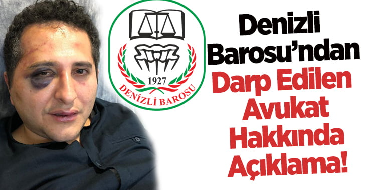 Denizli Barosu’ndan Cumhurbaşkanlığı Korumalarının Darp ettiği Avukat Hakkında Açıklama!