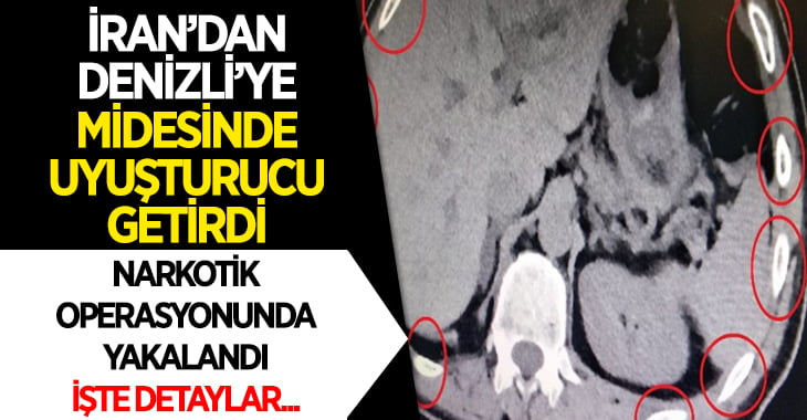 İran’dan Denizli’ye Midesinde Uyuşturucu Getirdi