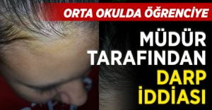 Denizli’de öğrenciye müdür tarafından darp iddiası