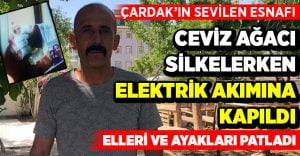 Çardak’ın sevilen esnafı elektrik akımına kapıldı, elleri ve ayakları patladı