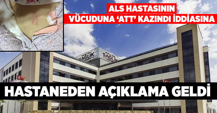 ALS hastası kadının vücuduna ‘ATT’ kazındı iddiasına, hastaneden açıklama geldi