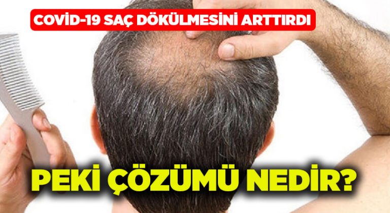 Covid-19 saç dökülmesini arttırdı.. Peki çözümü nedir?