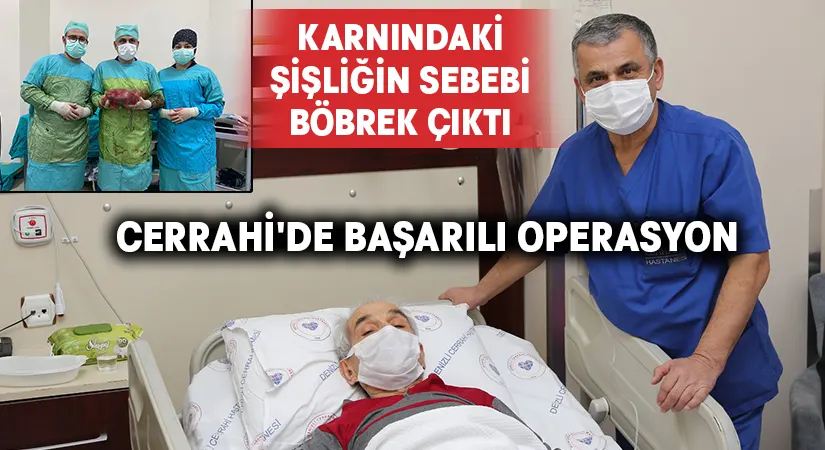 Karnındaki şişliğin sebebi böbrek çıktı.. Cerrahi’de başarılı operasyon