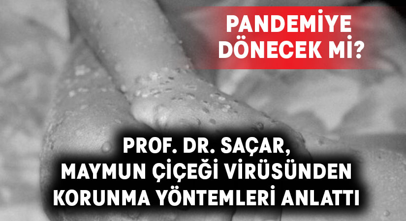 Prof. Dr. Saçar, Maymun çiçeği virüsünden korunma yöntemlerini anlattı