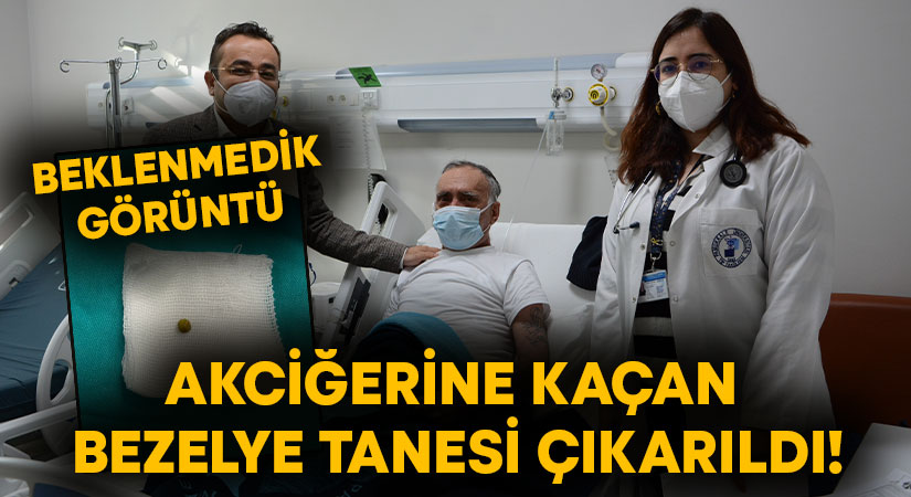 Akciğerine kaçan bezelye tanesi çıkarıldı!