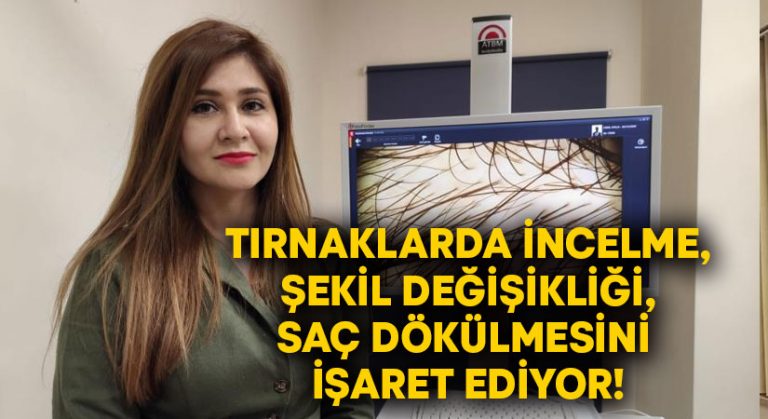 Tırnaklarda incelme, şekil değişikliği, saç dökülmesini işaret ediyor!