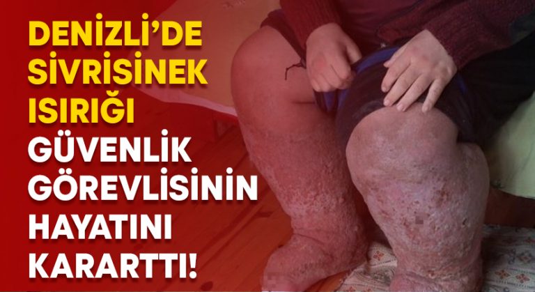 Sivrisinek ısırığı güvenlik görevlisinin hayatını kararttı!